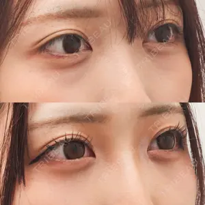東京イセアクリニックの症例