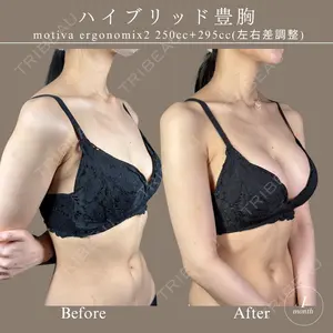 藤・ナチュレ美容クリニック 銀座院 鍵野 攻允医師の症例