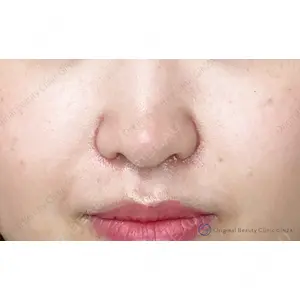 Original Beauty Clinic GINZA 佐藤玲史医師の症例