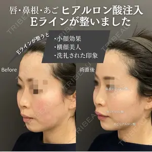 ロレシー美容クリニック 心斎橋駅前院 福留院長医師の症例