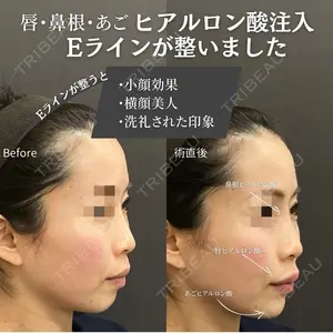 ロレシー美容クリニック 心斎橋駅前院 福留院長医師の症例