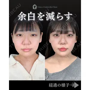 東京シンデレラ美容外科 池袋院 石井 達也医師の症例