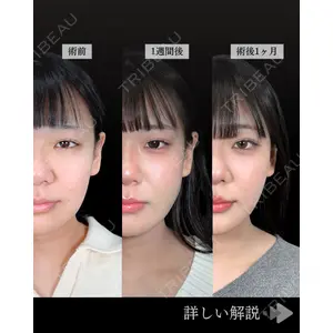 東京シンデレラ美容外科 池袋院 石井 達也医師の症例