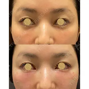 EMMO FACE CLINIC 大宮院 廣松 直樹医師の症例