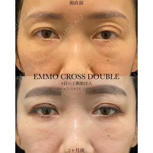 EMMO FACE CLINIC 大宮院 廣松 直樹医師の症例
