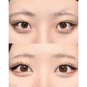 新宿美容外科ネビュラクリニック 山本 紘子医師の症例