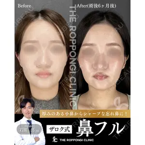 THE ROPPONGI CLINIC（ザ 六本木クリニック） 石黒 昂医師の症例