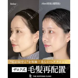 THE ROPPONGI CLINIC（ザ 六本木クリニック） 石黒 昂医師の症例