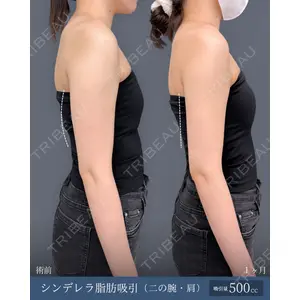 東京シンデレラ美容外科 新宿院 吉原 伯医師の症例