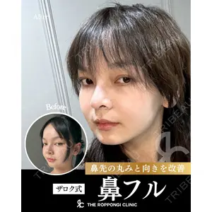 THE ROPPONGI CLINIC（ザ 六本木クリニック） 石黒 昂医師の症例