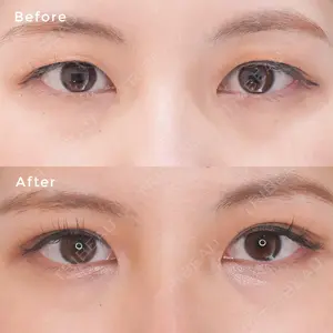 東京イセアクリニック 大山 希里子医師の症例