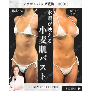 GLAMRULE CLINIC (グラムルール クリニック) 銀座院 藤林 万里子医師の症例