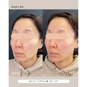 自由が丘ウェルエイジングビューティークリニック 福田 知佐子医師の症例