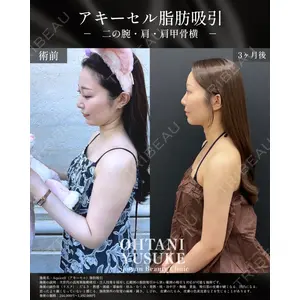 湘南美容クリニック Regno 銀座院 大谷 悠輔医師の症例