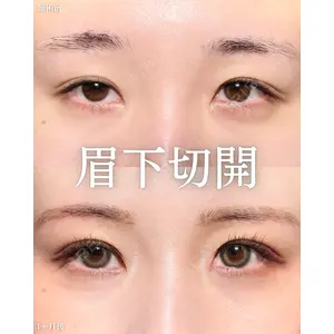 新宿美容外科ネビュラクリニック 山本 紘子医師の症例