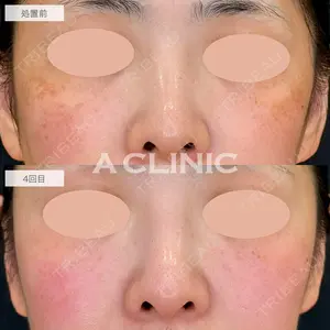 A CLINIC（エークリニック） 仙台院 伊藤 瑠桂医師の症例