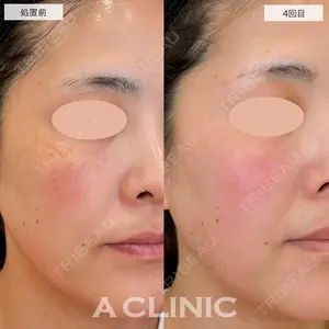 A CLINIC（エークリニック） 仙台院 伊藤 瑠桂医師の症例