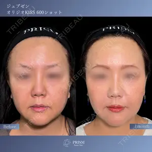 PRISM Beauty Clinic 新宿院 畑山 知輝医師の症例