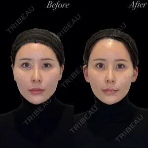 R Beauty CLINIC 銀座院 岩本　昌樹医師の症例