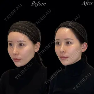 R Beauty CLINIC 銀座院 岩本　昌樹医師の症例