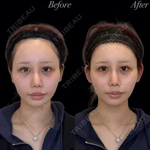 R Beauty CLINIC 銀座院 岩本　昌樹医師の症例
