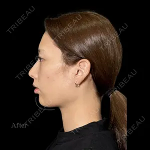 PRISM Beauty Clinic 新宿院 畑山 知輝医師の症例