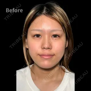 PRISM Beauty Clinic 町田院 森本 理一郎医師の症例