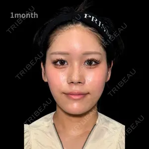 PRISM Beauty Clinic 町田院 森本 理一郎医師の症例