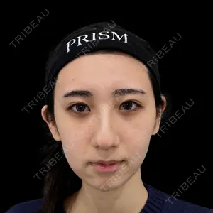 PRISM Beauty Clinic 町田院の症例