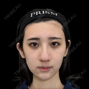 PRISM Beauty Clinic 町田院の症例