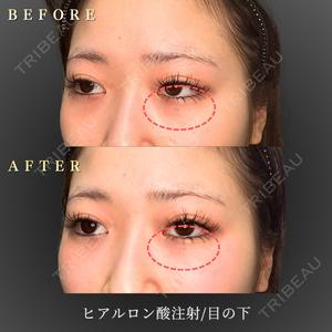 BiBiクリニック 山本 幸一郎医師の症例