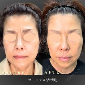 BiBiクリニック 山本 幸一郎医師の症例
