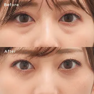東京イセアクリニック 大山 希里子医師の症例