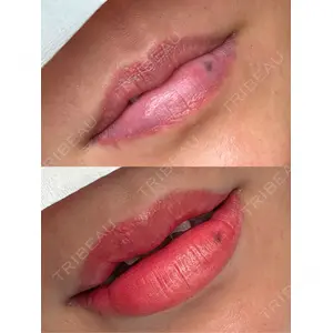 Belle Via Clinic 森田 佑望医師の症例