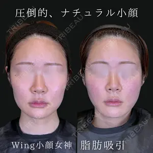 Wing clinic 豊中駅前院 速水 翼医師の症例