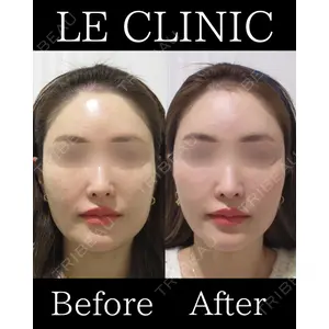 LE CLINICの症例