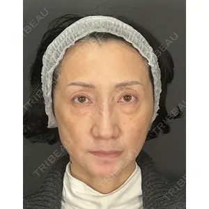 Mirrora CLINIC 田仲 祐貴医師の症例