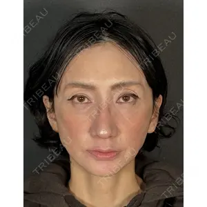 Mirrora CLINIC 田仲 祐貴医師の症例