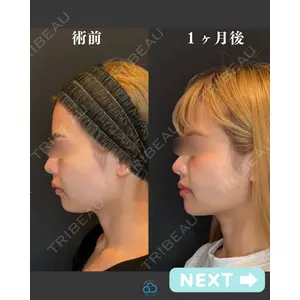 渋谷あおぞらクリニック美容外科・美容皮膚科 鶴田 優希医師の症例