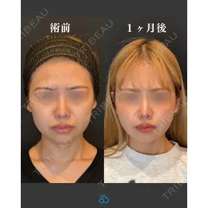 渋谷あおぞらクリニック美容外科・美容皮膚科 鶴田 優希医師の症例