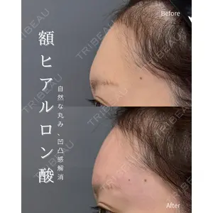 春山記念病院 山田 浩之医師の症例