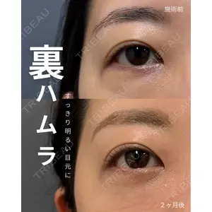 春山記念病院 山田 浩之医師の症例