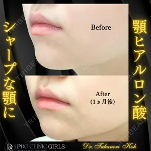 PRO CLINIC プロクリニック 銀座院 洪 嵩典医師の症例