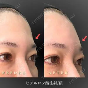 BiBiクリニック 山本 幸一郎医師の症例