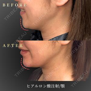 BiBiクリニック 山本 幸一郎医師の症例