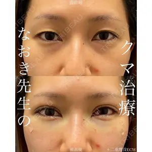 EMMO FACE CLINIC 大宮院 廣松 直樹医師の症例