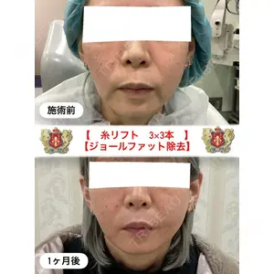 シャトークリニック 河合 秀紀医師の症例