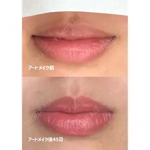 Belle Via Clinic 森田 佑望医師の症例