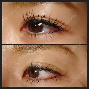 HAAB BEAUTY CLINIC 南青山本院（新院） 小平 佳典医師の症例