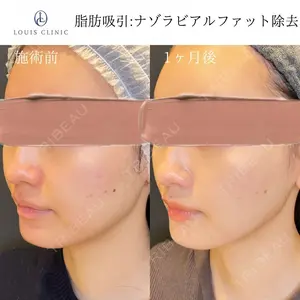 LOUIS CLINIC 二子玉川院【ルイクリニック】 小松 塁医師の症例